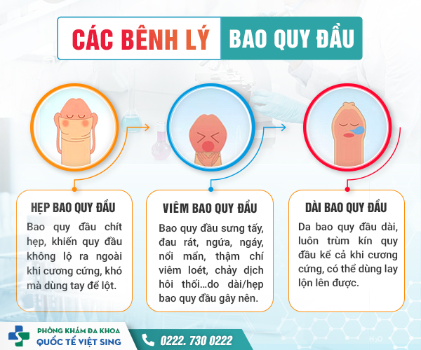 Đau nhức dương vật – Cẩn thận mắc bệnh nam khoa nguy hiểm