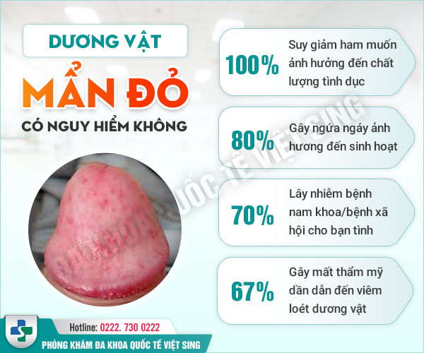 Dương vật mụn đỏ – Cẩn thận mắc bệnh xã hội nguy hiểm!