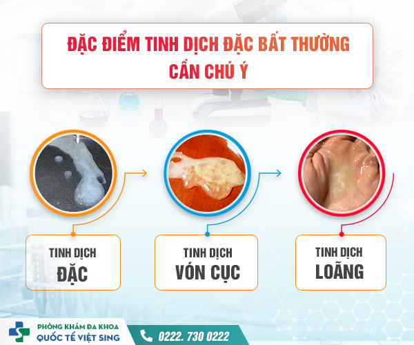 Tinh trùng vón cục cảnh báo điều gì – Đâu là hướng điều trị hiệu quả cho tình trạng này?