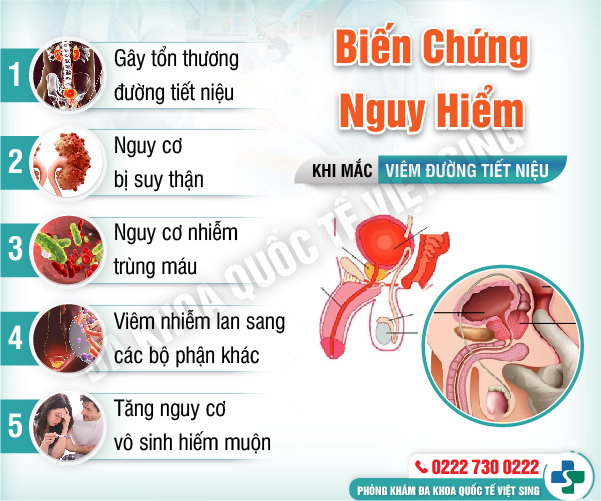 [CHI TIẾT] Chi phí chữa viêm tiết niệu tại Đa khoa quốc tế Việt Sing Bắc Ninh