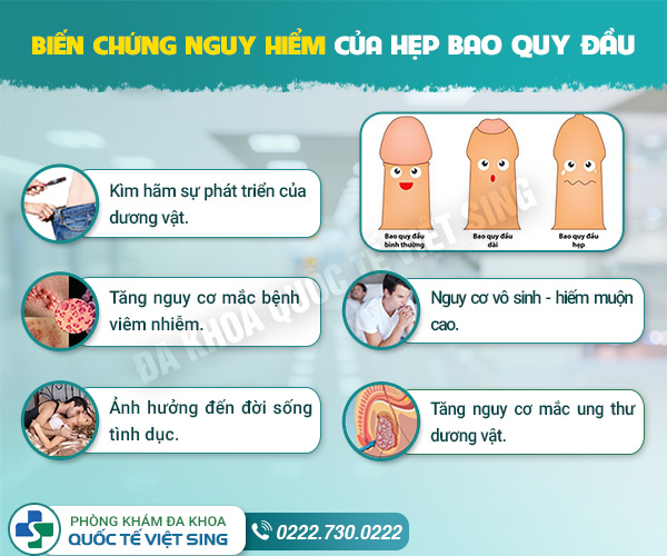 Nhận biết sớm triệu chứng hẹp bao quy đầu – điều trị kịp thời, hạn chế rủi ro