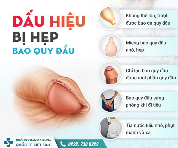 https://khambenhnamkhoa.com/wp-content/uploads/2023/07/dau-hieu-hep-bao-quy-dau.jpg