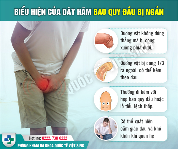 Bác sĩ Ngoại khoa giải đáp: Dây hãm bao quy đầu là gì và những điều nam giới cần biết