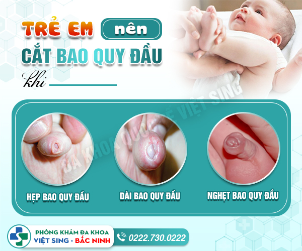 Bác sĩ chuyên khoa giải đáp: Có nên cắt bao quy đầu ở trẻ em không?