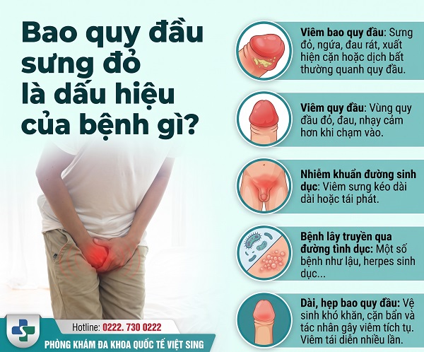 Bao quy đầu sưng đỏ là bị gì? Khi nào cần đi khám?